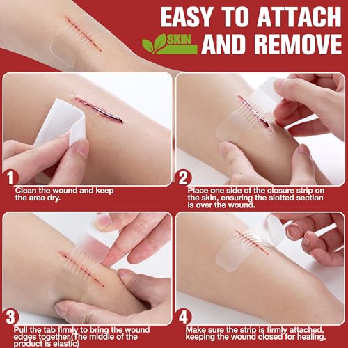 Emergency Wound Closure Strips - HSA/FSA Eligible - Dotodo 4PCS Laceration Closure Kit - Sutures Butterfly Bandaids | Stre...