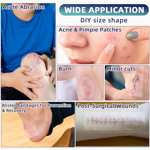 Hydrocolloid Roll for Wound Care, 2in x 5ft - Latex-Free & Hypoallergenic Hydrocolloid Bandages with Self-Adhesive, Ultra ...