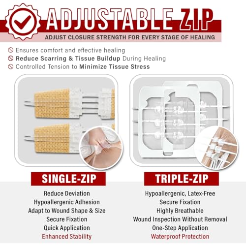 EVERLIT CARE Wound Closure Kit | 28 Pcs All-in-One First Aid with Suture-Free, Stitchless Zip Devices, Butterfly Bandages,...