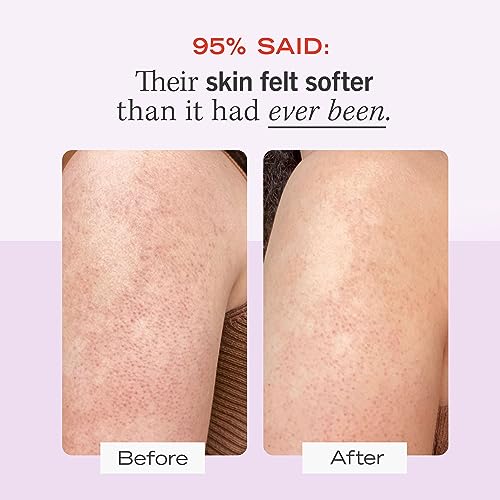 First Aid Beauty - Jumbo Body Duo: KP Bump Eraser Body Scrub & Ingrown Hair Pads with 10% BHA & AHA, Daily Exfoliating Bod...