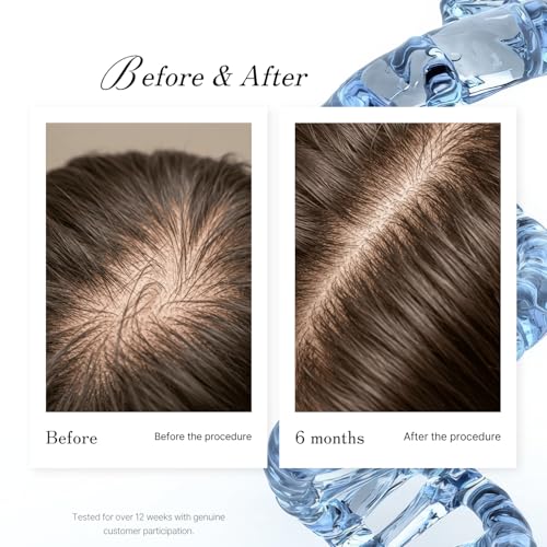 DNA-Pollen Hair Growth Stimulating Treatment Proven Effective Against Hair Loss for Thicker and Fuller Hair