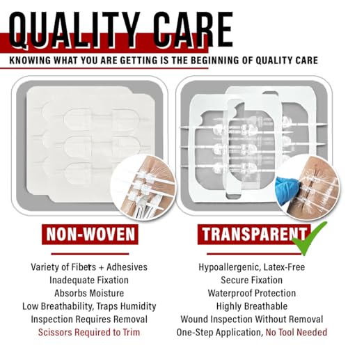 EVERLIT Wound Closure Kit | Surgical Zip-Stitch Devices for Cut & Laceration | Sterile, Suture-Free, Stitch-Less Adhesive ...