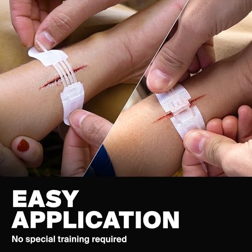 SurviveX Zip Stitch Wound Closure Strips - Repair Wounds Without Stitches - Zipstitch Sutures - Laceration Closure First A...