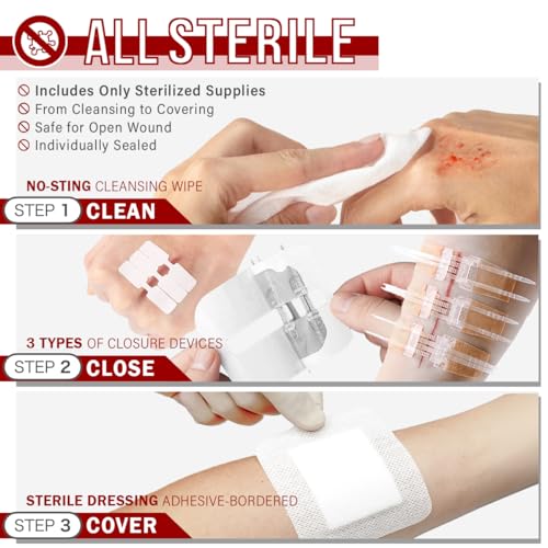 EVERLIT CARE Wound Closure Kit | 28 Pcs All-in-One First Aid with Suture-Free, Stitchless Zip Devices, Butterfly Bandages,...