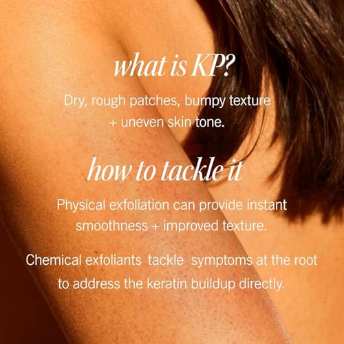 First Aid Beauty - KP Bump Eraser Body Scrub with 10% AHA, Keratosis Pilaris Skin Exfoliater with Glycolic and Lactic acid...