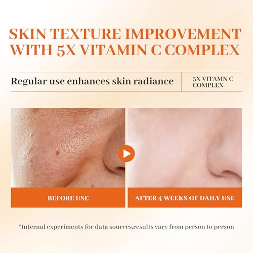 5X Vitamin C Toner HONLINK Facial Care Toners,Gift for Her, Hyaluronic Acid Hydrating Facial Treatment for Even Skin Tone,...