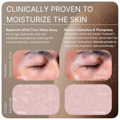 GLOW Anti Aging Supplement - Hyabest® Hyaluronic Acid, Phytoceramides, 5000 mcg Biotin, Vitamin A, C, E, Zinc - Hair Skin ...