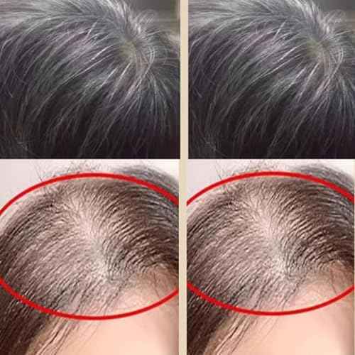 Saffron Hair Blackening Spray, Saffron Black Hair Spray, Essence Spray Saffron And Polygonum Multiflorum, Nourishing Hair, Moisturizing, For Men And Women (3PCS)