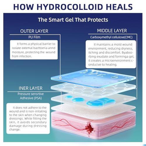 Hydrocolloid Roll for Wound Care, 2in x 5ft - Latex-Free & Hypoallergenic Hydrocolloid Bandages with Self-Adhesive, Ultra ...