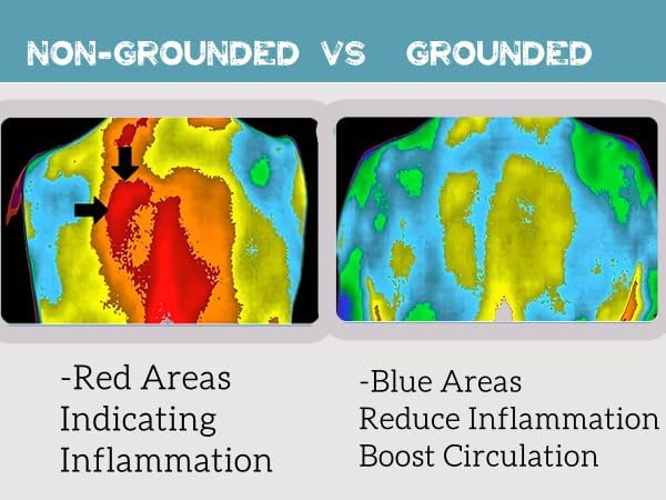 Grounding Sheets Queen Size,10% Silver Grounding Bed Sheets Grounding Fitted Sheets for Reduce Stress (60 x 80 x 14 inches)