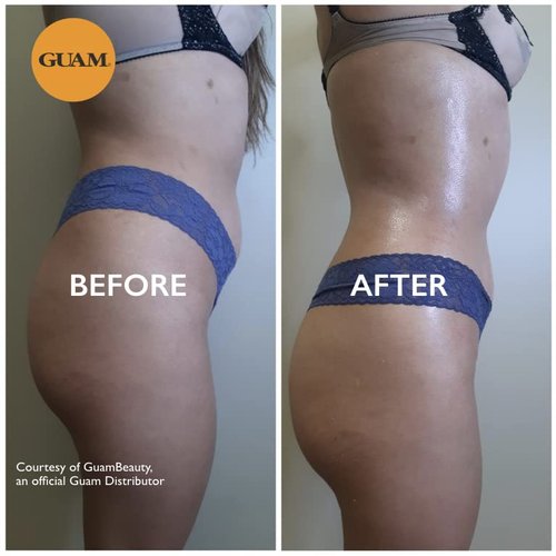 Guam Draining Body Wrap, DREN PLUS Seaweed Mud Body Wraps for Lymphatic Drainage against Water Retention and Swelling (1.1 LB)