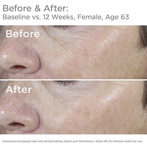 SkinMedica Total Defense + Repair SPF 34 Sunscreen for Face. This Lightweight, Facial Sunscreen is Ideal for Oily and/or Combination Skin, 2.3 Oz