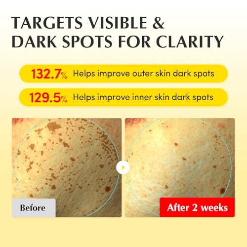 EQQUALBERRY Vitamin Illuminating Cream – Vitamin C & 5% Niacinamide + 3% TXA | Dark spots Cream | Ceramide Barrier Strengt...