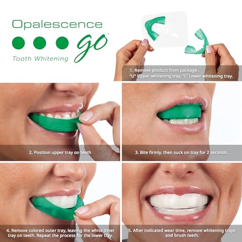 Opalescence Go 15- Prefilled Teeth Whitening Trays - 15% Hydrogen Peroxide - (10 Treatments) Made by Ultradent Products. T...