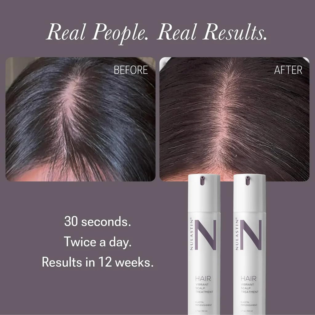 NULASTIN Scalp Serum - Vibrant Scalp Treatment to Help Improve the Look of Hair Density - Lightweight, Fast Absorbing Formula Enriched with Hair-Strengthening Ingredients (1.7 Oz)