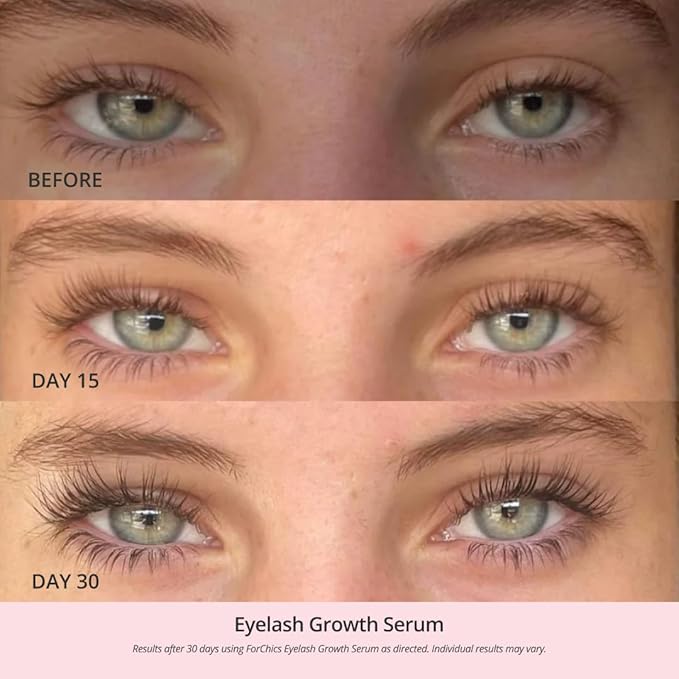 ForChics Lash Growth and Volume Duo - Growth Serum + Nourishing Mascara | 24/7 Lash Transformation System - Prostaglandin-Free, Hormone-Free - Instant Volume + Long-Term Growth