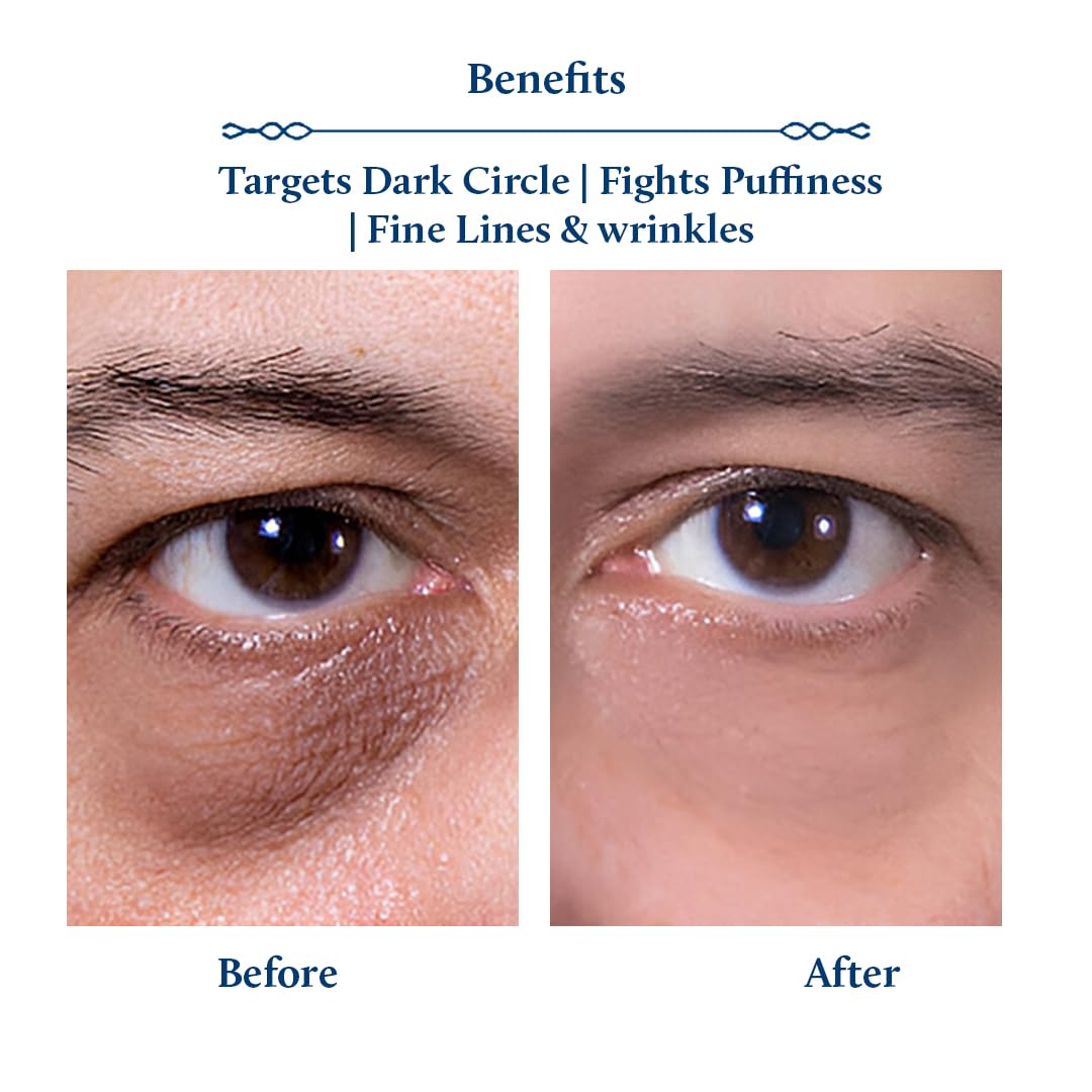 Blue Nectar Shubhr Under Eye Cream for Dark Circles with Papaya, Potato Starch & Niacinamide | Best Under Eye Cream for Men | Ey