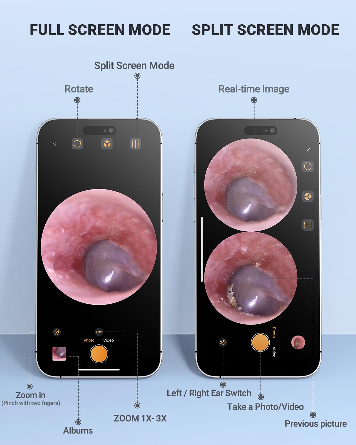 AnyScope Digital Otoscope Compatible with iPhone and Android Devices, HD Ear Camera with Ear Wax Removal Tools, Video Ear Scope Otoscope with Light, Capture Photos and Videos (Silver)