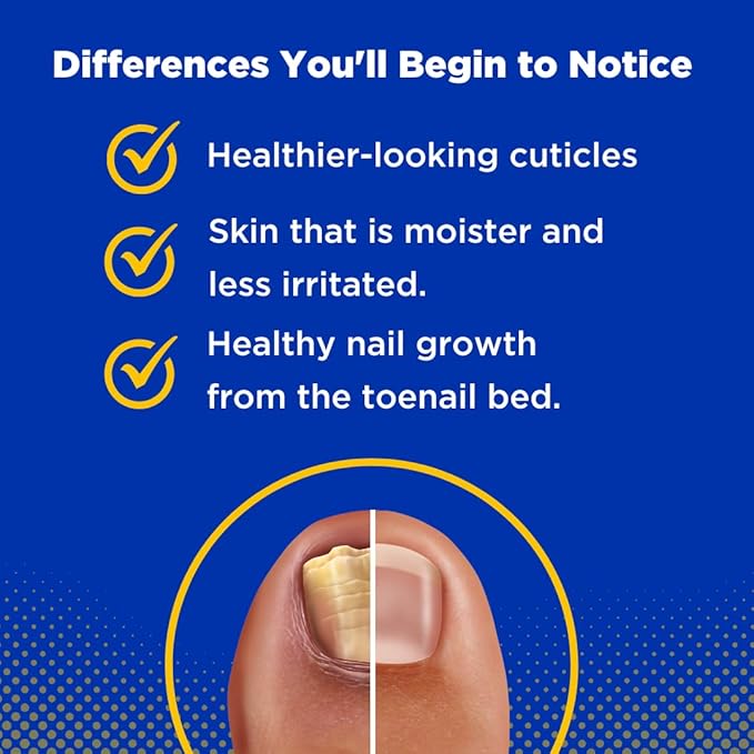 Baar Products - Toelieva Antifungal Liquid Solution - 25% Undecylenic Acid, Organic Olive Oil, Grapefruit Seed Extract - Maximum Strength - Fights Fungus Under & Around Toenails - 2 oz