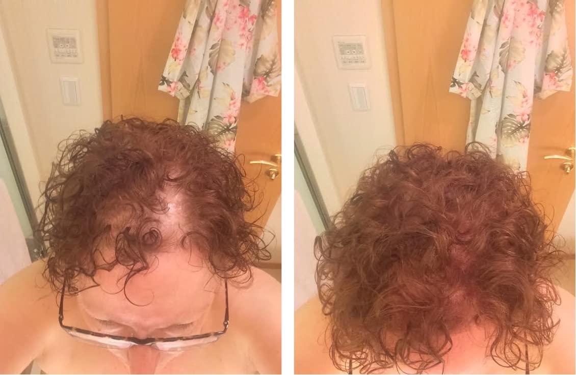 Caboki Hair Loss Concealer. All-Natural, Plant-Based Hair Building Fiber. Covers Bald Spot and Thinning Hair. Make Thin Hair Look 10X Fuller Instantly.(30G, 90-Day Supply). Light Auburn