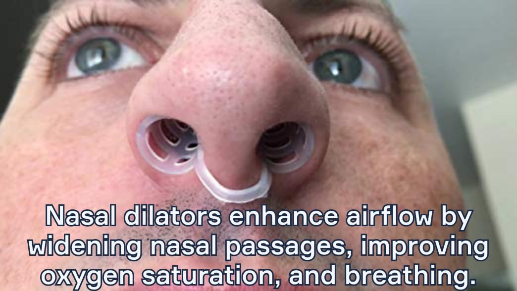 Snore Bastion Nasal Dilators for Sleeping - 4 of X-Large ONLY (XL) Soft Silicone Nasal Cones - Nostril Opener - Nasal Expander for Breathing - Nose Vents - Anti Snoring Devices
