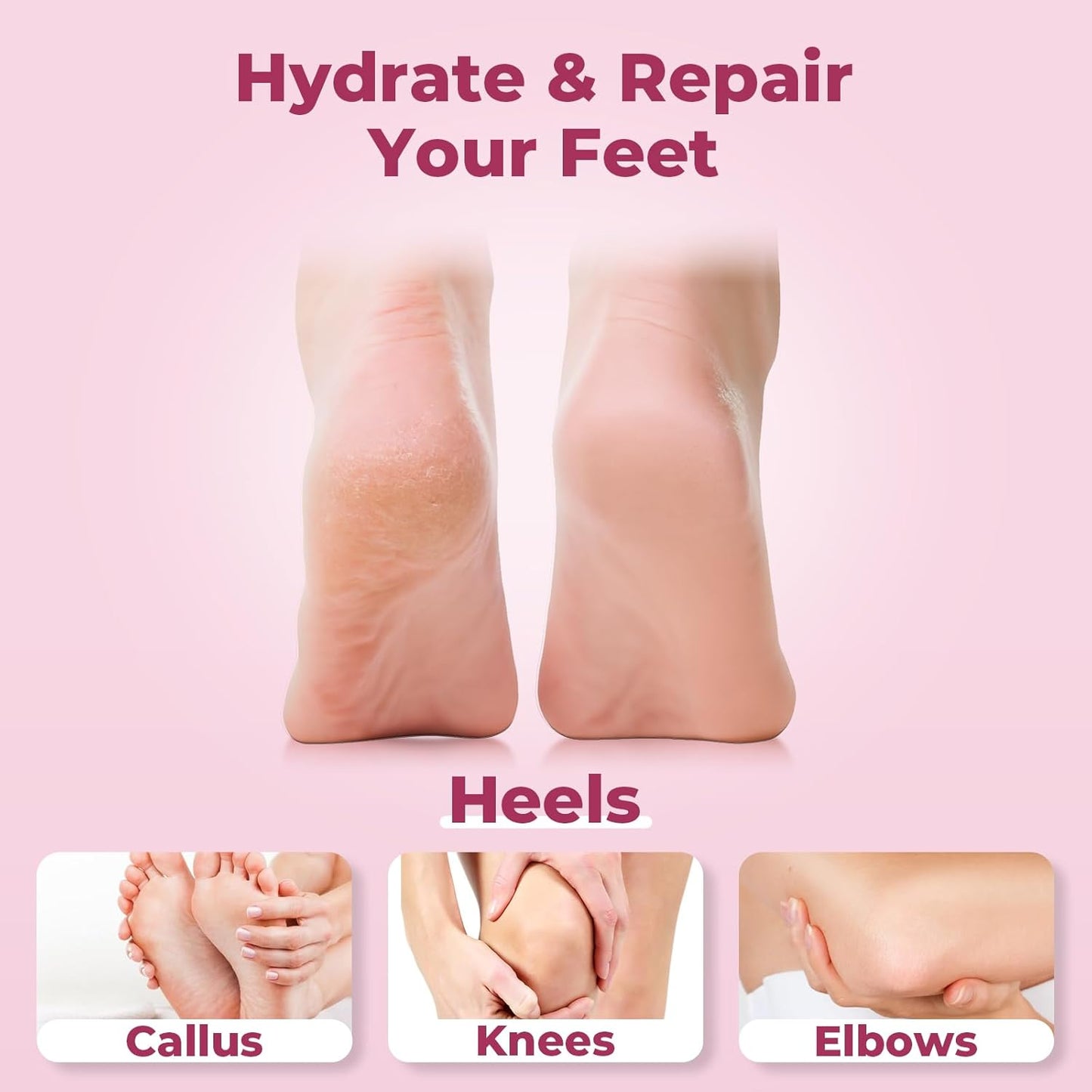 Urea Cream 40 Percent for Feet Maximum Strength, Foot Cream for Dry Cracked Heels and Feet, Moisturizer with 40% Urea and 2% Salicylic Acid, 5.29 oz