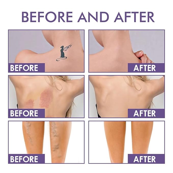 Body Coverage Perfector 3PCS Waterproof Transfer-Resistant Leg & Body Makeup, Long Lasting Tattoo Cover Up Makeup