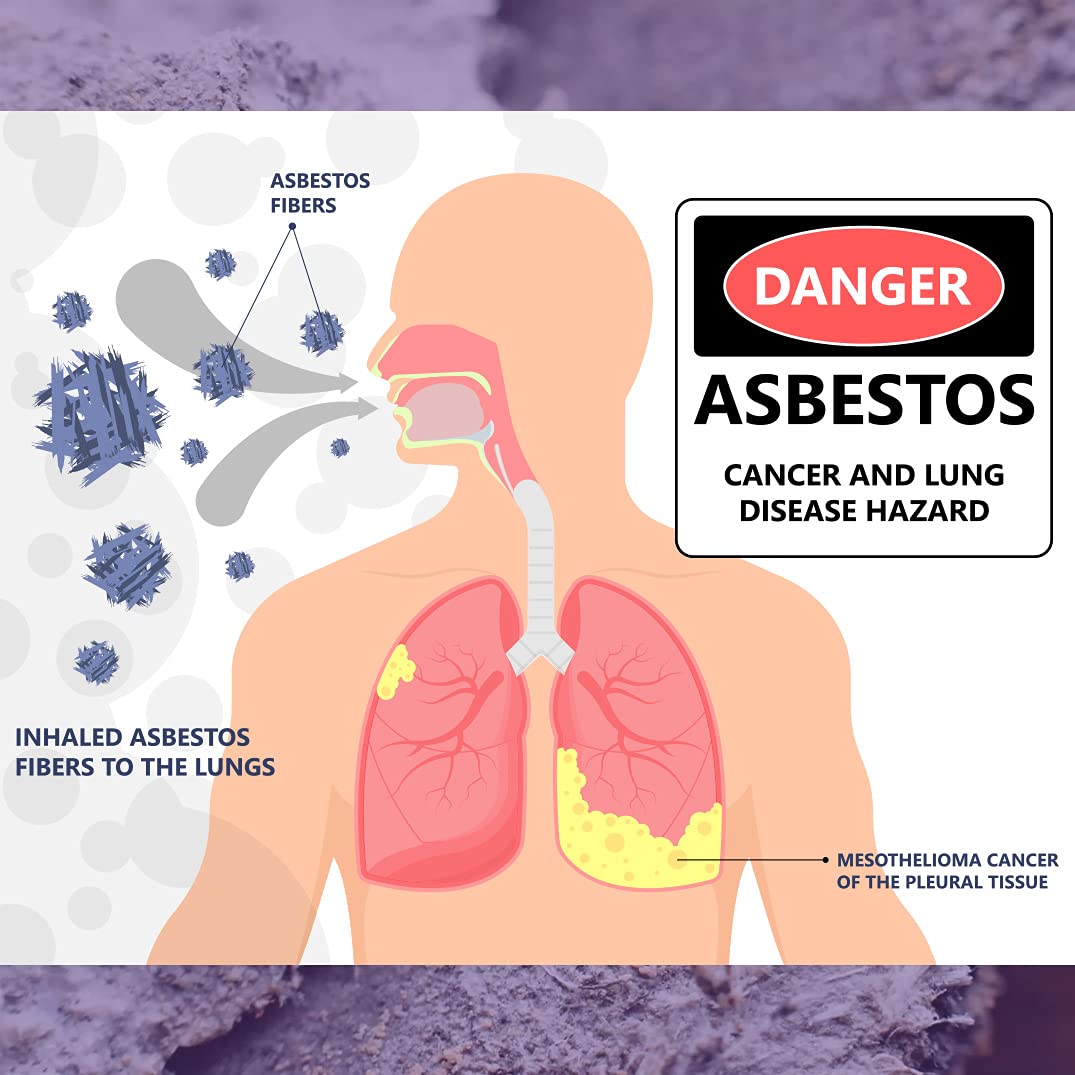 Asbestos Test Kit - (2 Samples) Emailed Results Within 3 to 5 Business Days - Includes Return Mailer and Expert Consultation. Required Lab Fee for NVLAP Analysis
