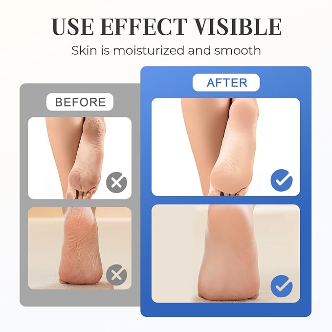 Hydrating and Anti-Cracking Foot Cream, 2025 Moisturising and Relieves Cracking and Dryness Foot Cream, Hand and Foot Repair Cream for Women & Men Callused, Feet, Knee, Elbow, Hand (WHA-1PC, #01)