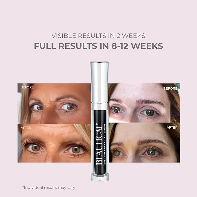 Eyelash Serum – Lash Enhancing & Conditioning Formula with Botanical Ingredients for the Appearance of Fuller, Shinier & Healthier-Looking Lashes – Nourishing Lash Care, 3ml