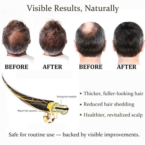 Thicair Hair Regrowth System - Advanced Hair Growth Treatment with Copper Peptides & Collagen, Knotweed and Ginseng Root Extract, Hydrating & Fuller Hair Kit for Fine or Thinning-Looking Hair (1 Pack)