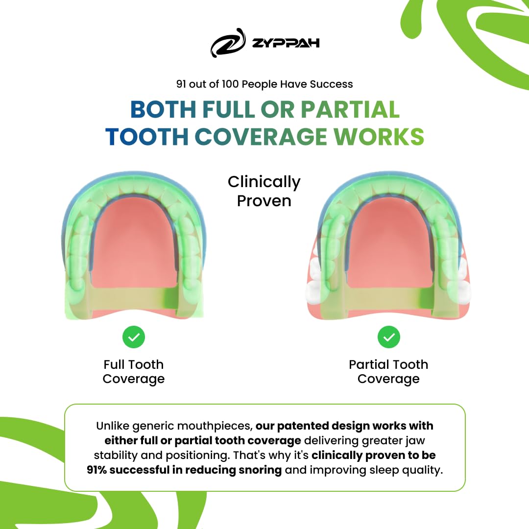 ZYPPAH - Edge - Anti-Snoring Solution