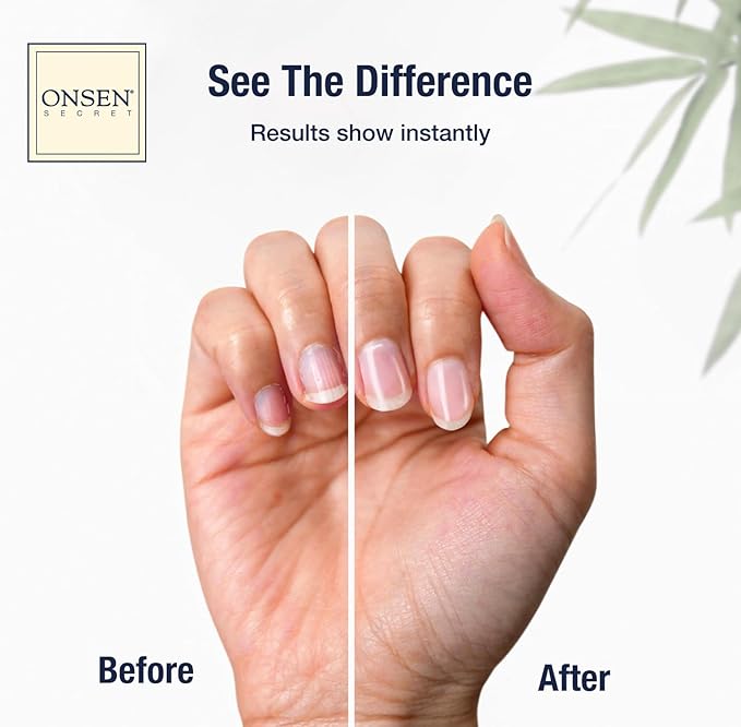 Onsen Nail & Cuticle Cream Treatment w/Japanese Tsubaki, Jojoba & Lavender Oil, Shea Butter - Strengthens Nails, Softens Cuticles - Daily Repair Care (1 Count/15 ml)