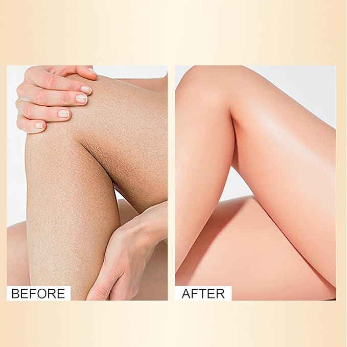 Leg Makeup Waterproof No Transfer, Leg Vein Cover up Makeup, Long-Lasting Body Concealer Makeup Lotion, Coverage for Vein, Scar, Tattoo for All Skin Tones (Medium Glow)