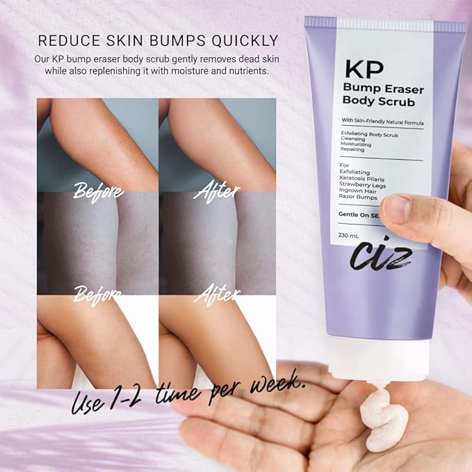 Back Acne Spray + KP Bump Eraser Body Scrub – Complete Body Acne & Texture Treatment Set