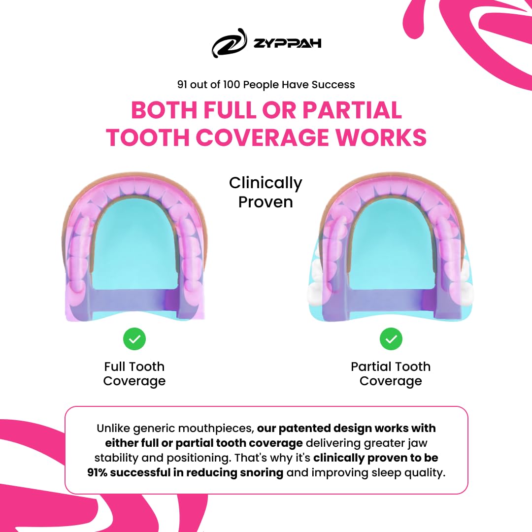 ZYPPAH Anti Snoring Hybrid Oral Mouthpiece | Mouth Guard for Better Sleep - Mouthpiece with Tongue Strap to Stop Snoring - Custom Mold for Mouth - Happy Sleep - Beauty Sleep - 2.25 x 2.75 x 1 inches