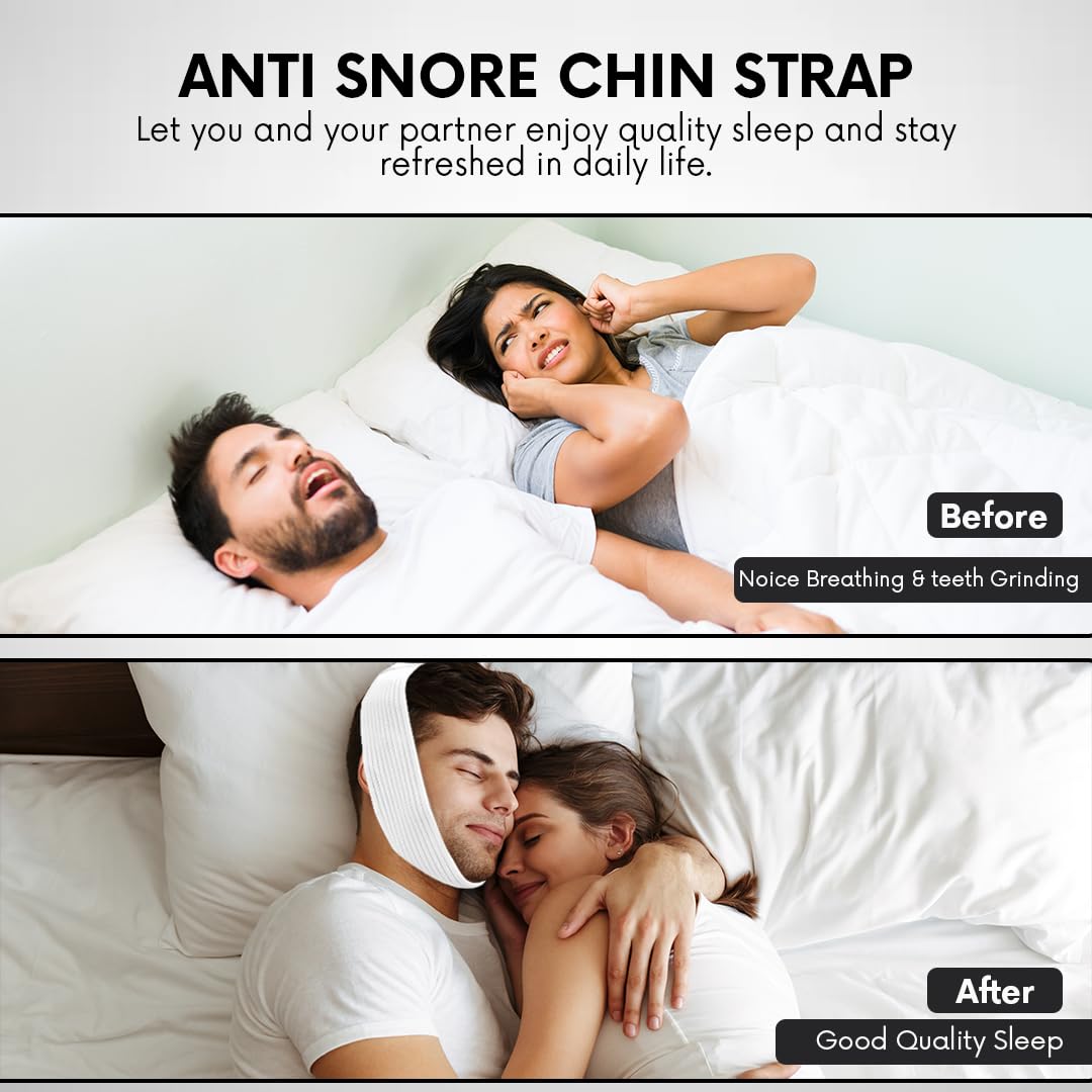Bistras Super Deluxe White Chin Strap with Extra Support- Anti Snore Chin Strap (2 pk)