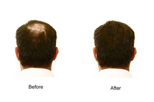 My Secret Hair Enhancer Dark Brown 5oz 3 pack