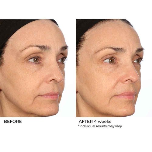NassifMD Pro Peptide Collagen Serum, Clinical Grade with Premium Ingredients for Hydrated Smooth Skin, Lightweight Fast-Absorbing Anti-Aging Formula for Softer Texture and Healthy Glow, 1 oz