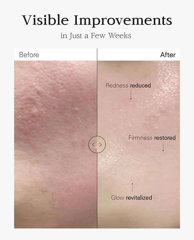 Nuborn Cell Placenta Stem Cell Intensive Repair Cream | Dragon Blood Cream with Placental Extract | Collagen Korean Skin Care for Glass Skin (50ml)