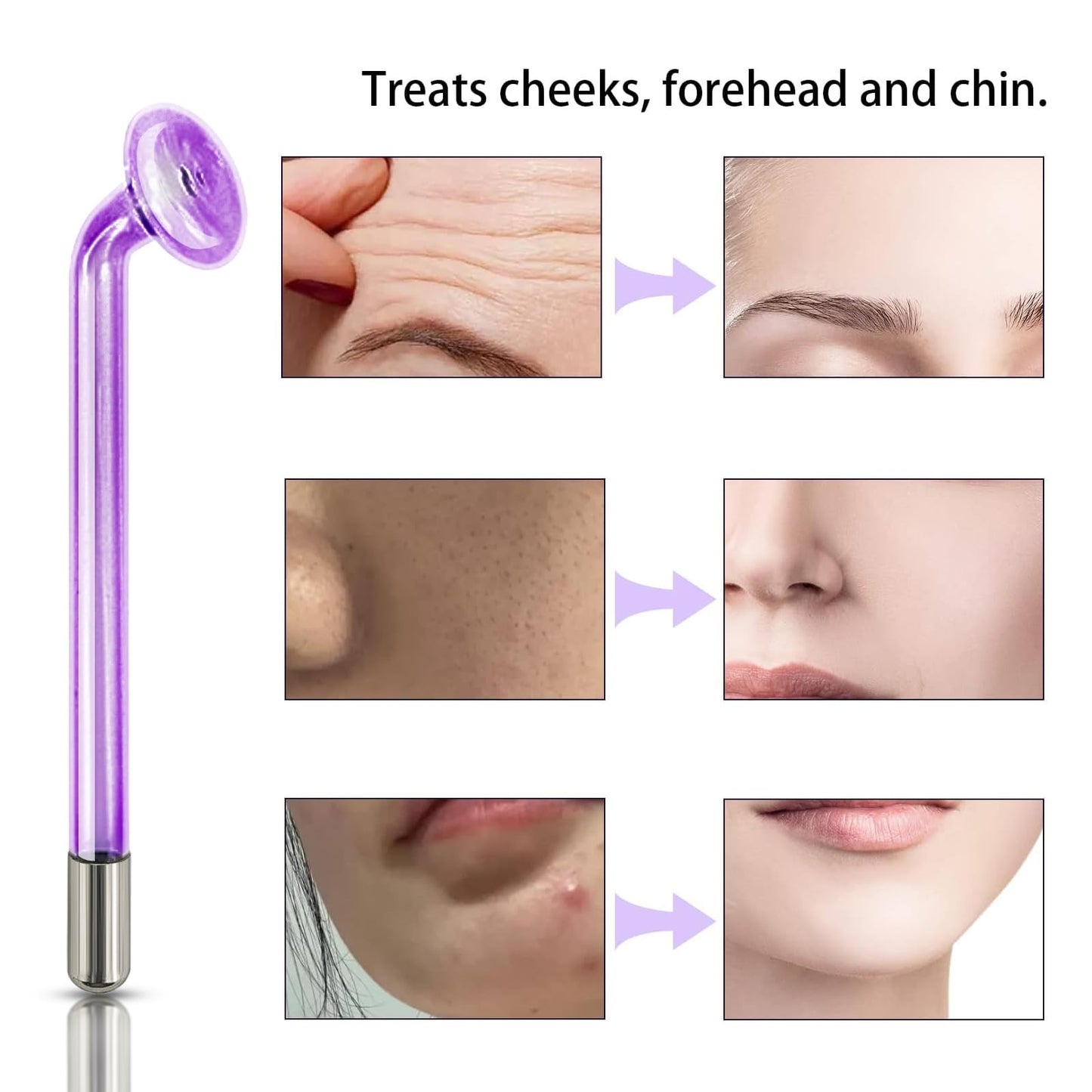 Spare Parts Mushroom for Handheld HIF Facial Hair Device Facial Care Orange Purple Blue Color Glass Tube Electrode Elitzia ETJX0