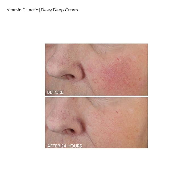 Dr Dennis Gross Vitamin C Plus Lactic Dewy Deep Cream Cream Unisex 2 oz