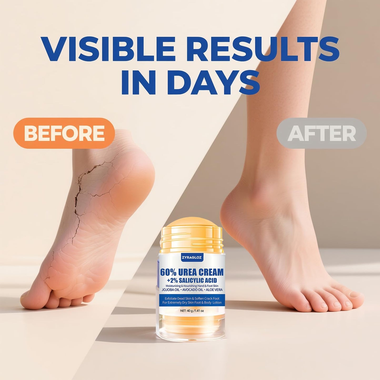 Urea Cream Stick 60% plus 2% Salicylic Acid, 2PCS Maximum Strength Urea Cream for Feet, Foot Lotion Stick for Cracked Heels, Dry