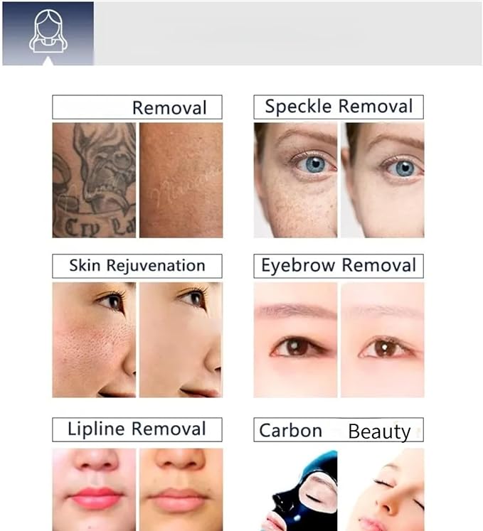 Painless 2-in-1 Hair Removal Device for Home Use, Suitable for Both Men and Women in Multiple Areas, Professionally Removes Melanin, Lightens Spots and Whitens The Skin