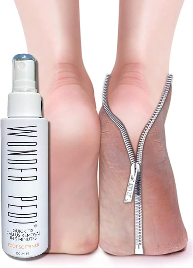 Callus Remover - Three Minutes Fix- Foot File Rasp - Instant Foot Exfoliating Softener Peel Spray, Heels Callus Scrubber File - Home Spa Pedicure Treatment. Wonder Pedi