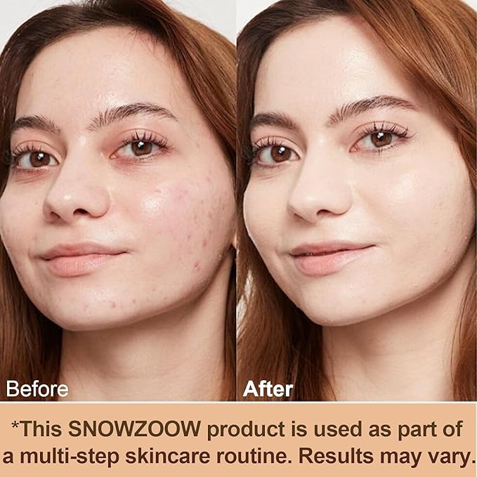 Medium 4 in 1 Hydrating full coverage concealer Lighting Foundation Liquid-Longwearing & Waterproof-korean makeup with SPF 50+1oz(30ml)