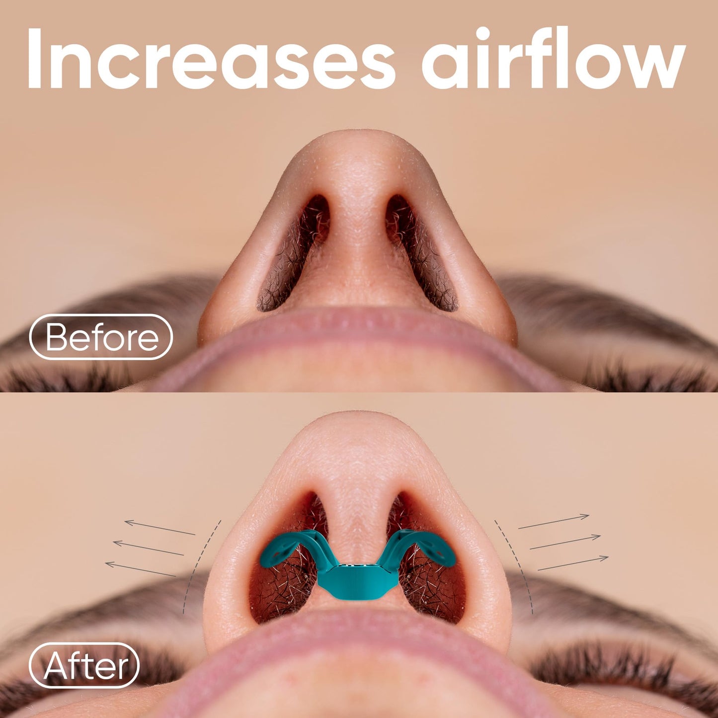 Brison Nasal Dilators for Breathing and Sleeping - 3 Pack Anti Snoring Nose Vents Opener for Better Breathing Sleeping and Activity Improves Airflow - Hard