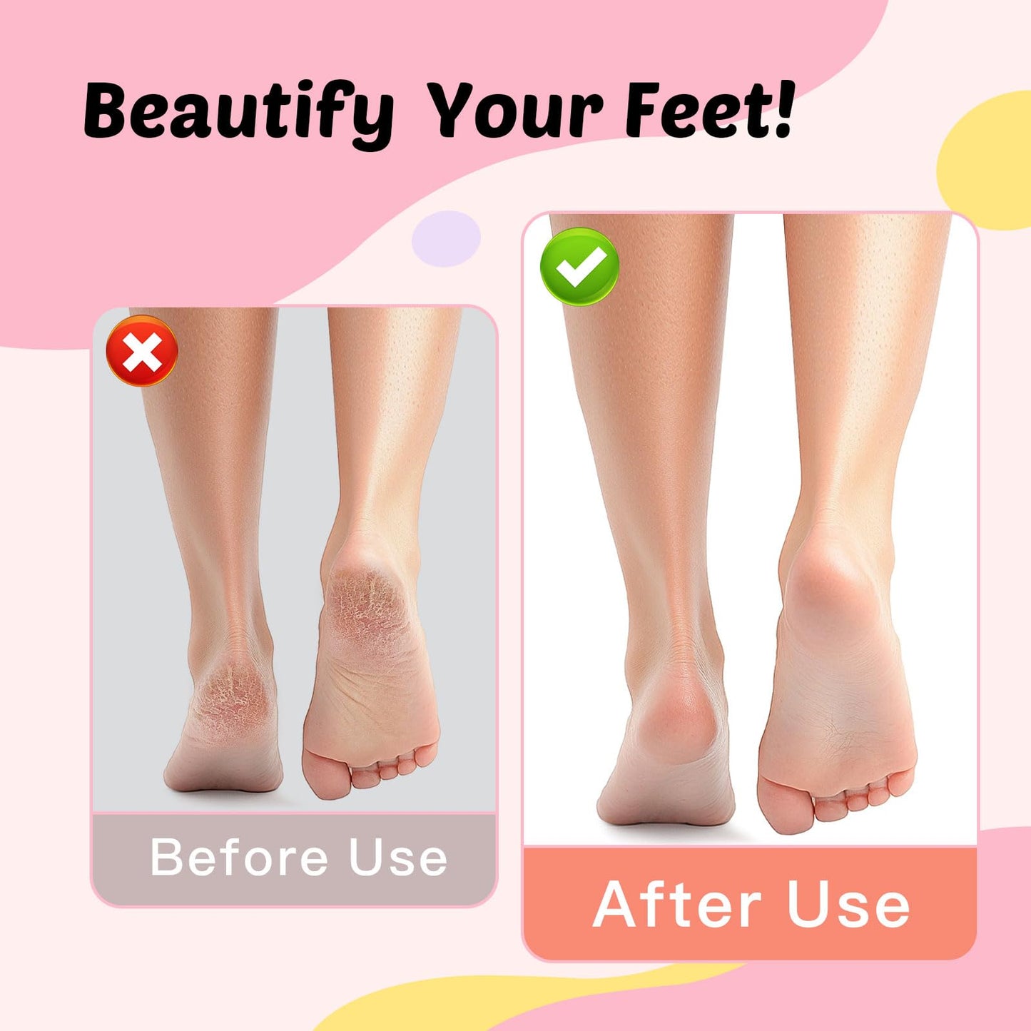 Dolcevitae Electric Foot Callus Remover & Nail File - Electric Callus Remover for Feet, 9 Adjustable Speeds, 1800mAh Rechargeabl