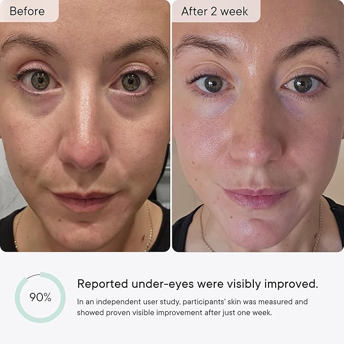 Qure Micro-Infusion Anti Wrinkle Patches for Smile Line, Frown lines, Under Eye Bags, Puffiness, Crow's Feet - Retinol, Caffeine, Niacinamide & Peptides - Dissolvable for Overnight Use - 16 Pairs