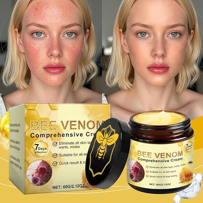 Bee Venom Comprehensive Cream, Bee Venom Skin Treatment Cream, All-in-One, Lifting & Firming, Anti-Aging Moisturizing, Effectively reduces all types of skin blemishes (2pcs)